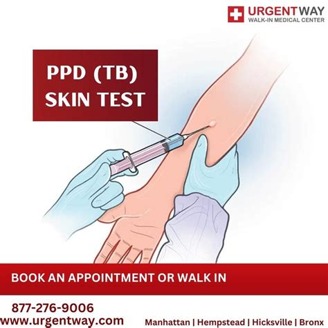 tb test results images|TB (Tuberculosis) Test: Purpose, Procedure.